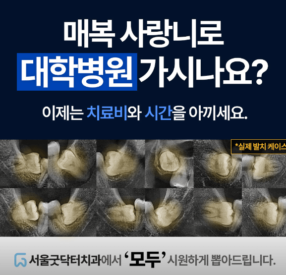 강동구 암사동 임플란트 치과