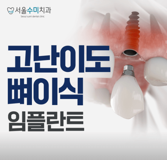 서울 중구 남창동 임플란트 치과