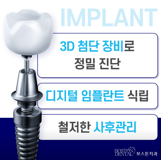 종로구 송현동 임플란트 치과