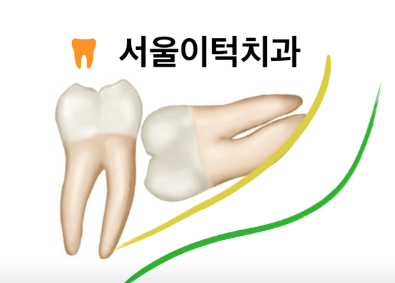 모래내시장역 임플란트 치과