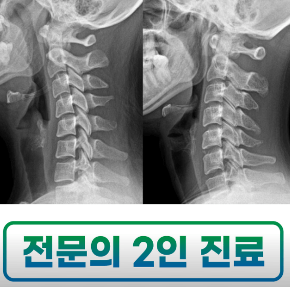 서울 동작 도수치료