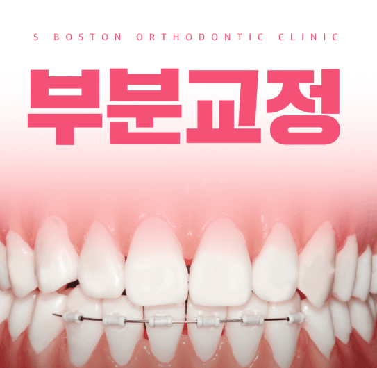 서울 성동구 치아교정