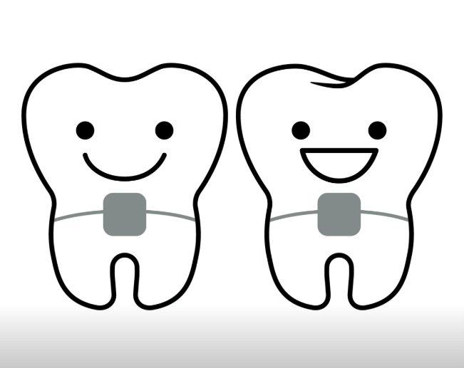 동해시 치아교정
