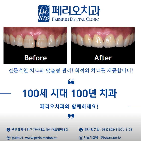 동의대역 임플란트 치과