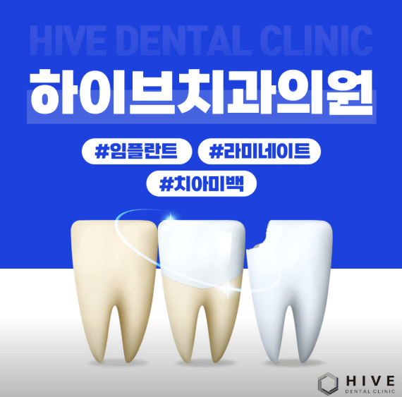 서면역 임플란트 치과