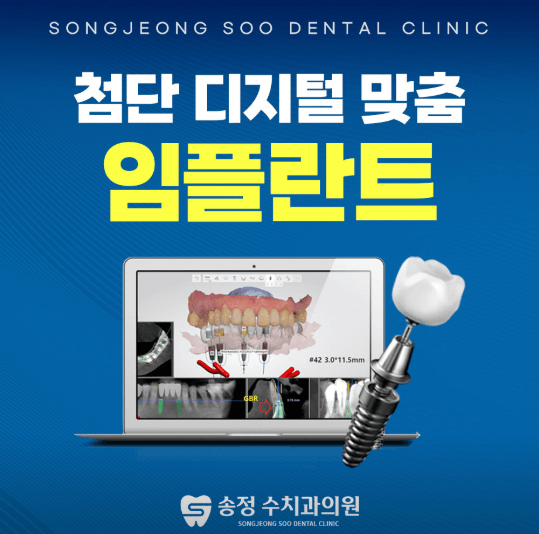 광주 송정역 임플란트 치과